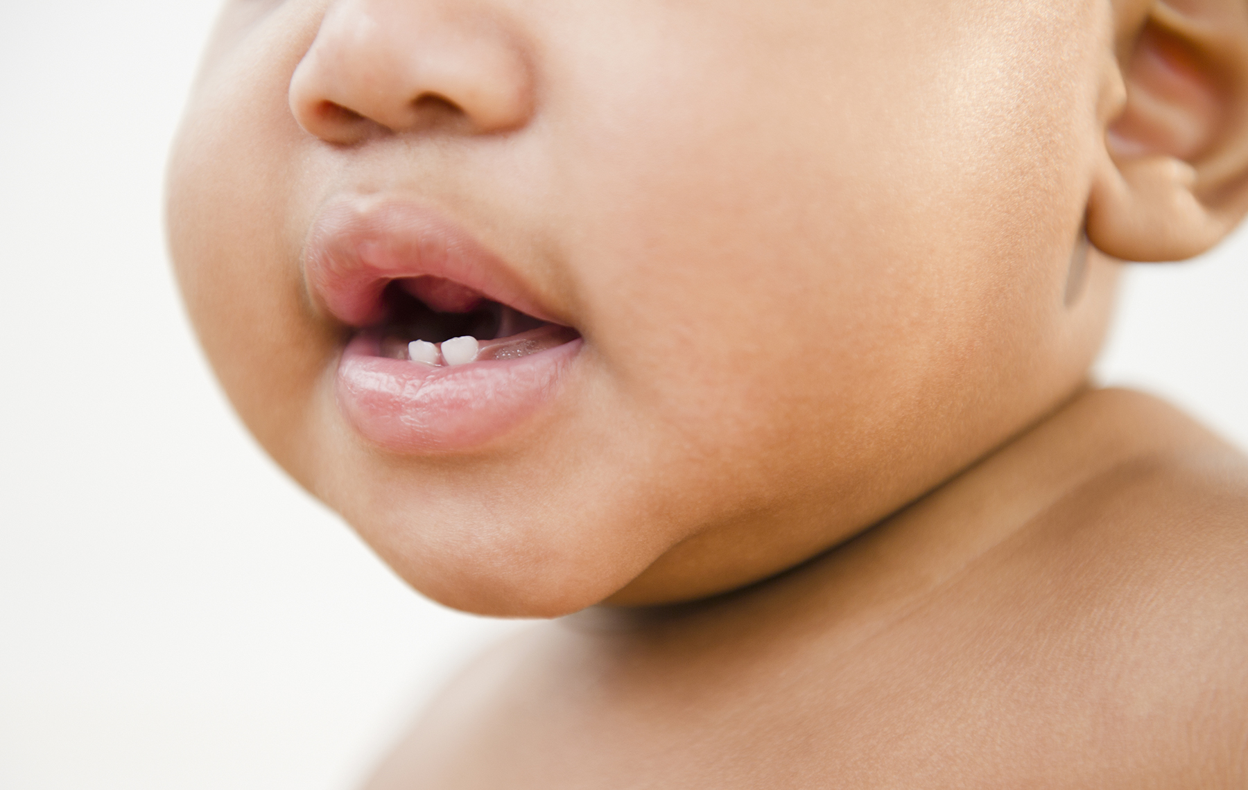 AltaMed baby showing two small teeth